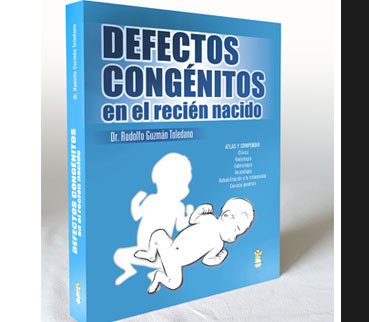 Portada del libro Defectos Congénitos en el recién nacido del Dr. Rodolfo Guzman Toledano